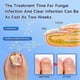 thumbnail image 5 of Nail Fungus Laser Treatment Device Fingernail Fungus Treat Onychomycosis Effectively Remove Onychomy, 5 of 5