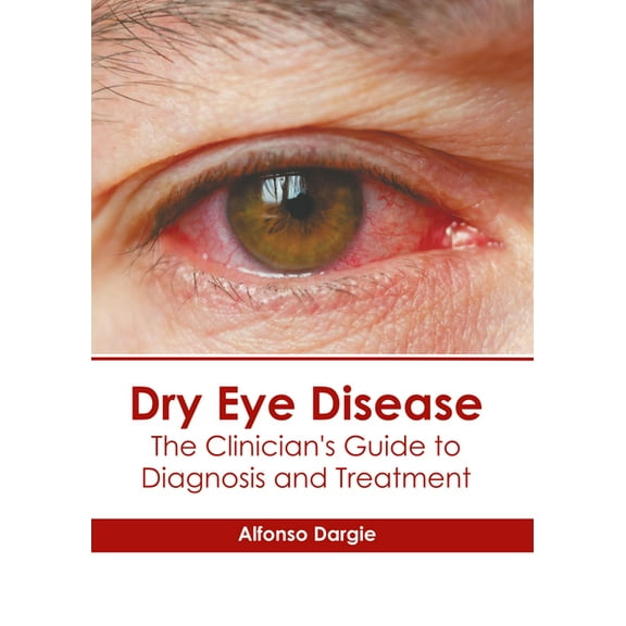 Dry Eye Disease: The Clinician's Guide to Diagnosis and Treatment, (Hardcover)