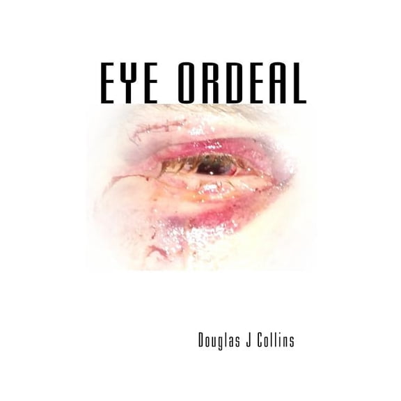 Eye Ordeal, (Paperback)