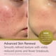 thumbnail image 2 of Crema REVITALE de ácido salicílico avanzado de 80 ml para rostro y cuerpo, 2 of 8