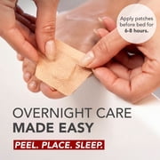 Kerasal Nighttime Renewal Fungal Nail Patch, Extra Strength, Overnight Repair, 14 Count