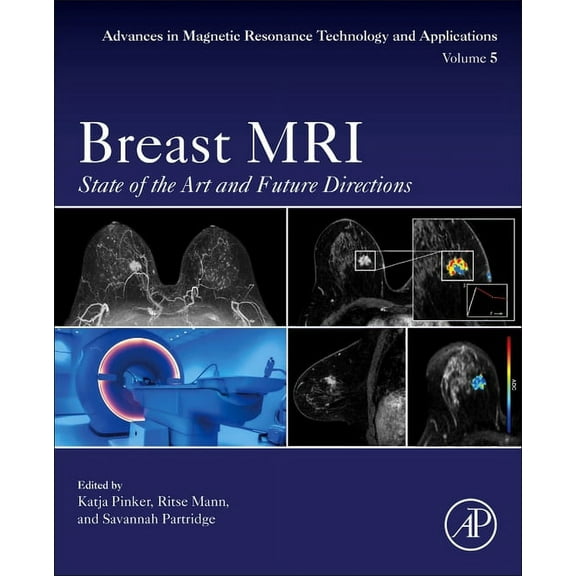 Advances in Magnetic Resonance Technolog Breast MRI: State of the Art and Future Directions Volume 5, Book 5, (Paperback)