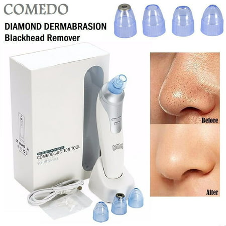Cooligg Electronic Vacuum Blackhead Suction Remover Extractor