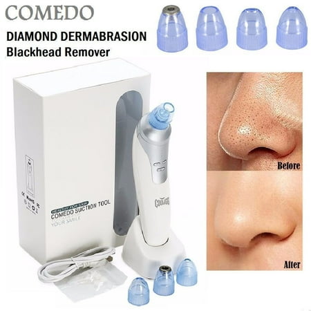 - Cooligg Electronic Vacuum Blackhead Suction Remover Extractor Cleaner