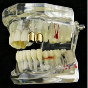 14k Gold Plated Double Two Tooth Grillz Left Side 2-Tooth Caps Slugs Hip Hop Grills