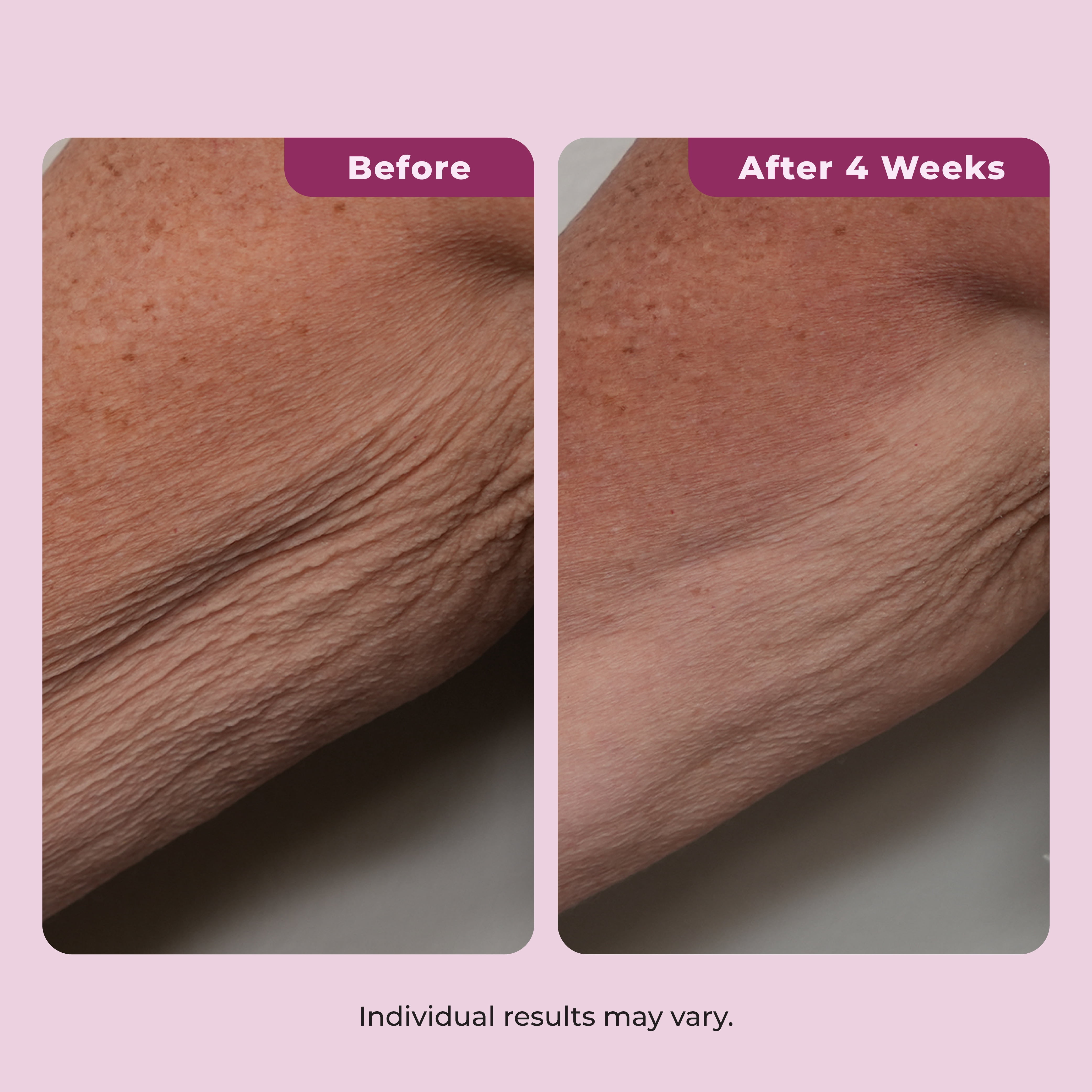 Dekliderm Neck Firming Cream for Neck, Chest & Arms – Tightening and Smoothing Cream for Crepey Skin, Wrinkles & Sagging Appearance