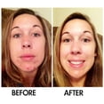 thumbnail image 6 of SkinSanity Clear Skin Results Regimen - All Natural Acne Treatment, 6 of 12