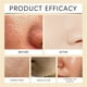 thumbnail image 3 of Mascarilla exfoliante Peel Off Mascarilla exfoliante reafirmante Mascarilla de limpieza profunda y desintoxicante, 3 of 4