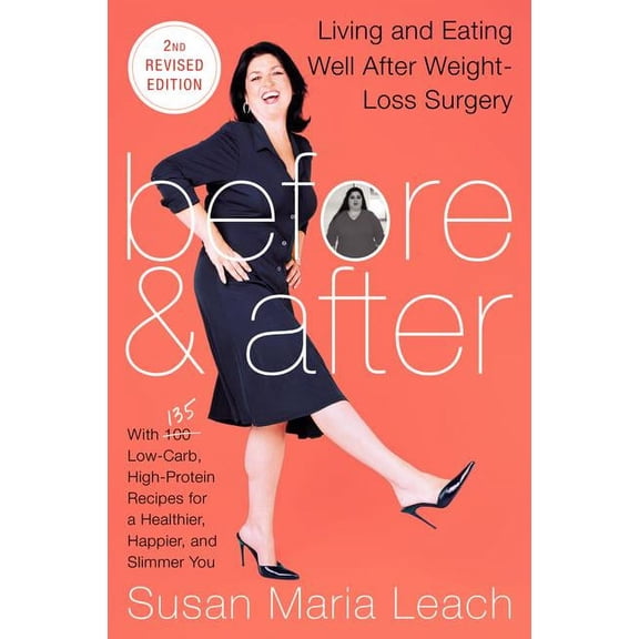Before & After, Second Revised Edition: Living and Eating Well After Weight-Loss Surgery, (Paperback)