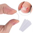 thumbnail image 1 of Ingrown Toenail Pedicure Tool 10Pcs/Bottle Straightening Clip Curved Bs Brace Toenails Thick Paronychia Correction Tool Foot, 1 of 5