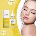 thumbnail image 1 of Suero calmante Fiudx facial control de grasa e hidratación 30 ml, 1 of 7
