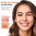 thumbnail image 3 of Parche hidrocoloide para acné Pimple Patches TKTK 609 unidades a granel, 3 of 9