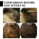 thumbnail image 5 of Fiudx Cera Capilar En Barra, Fórmula Batana Que Promueve El Crecimiento, Spray Hidratante para El Cabello, Cuidado Capilar Antirotura, para Hombres y Mujeres, Opción de Regalo para Peinado, Tamaño de, 5 of 7