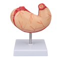 thumbnail image 4 of Yazoeia Human Stomach Model Simulated Stomach Anatomy Model Display Props for School Classroom Hospital Study MR318-3776, 4 of 13
