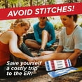 thumbnail image 3 of Clozex Emergency Laceration Closures - Repair Wounds Without Stitches. FDA Cleared Skin Closure Device for 2 Individual Wounds Or Combine for Total Length of 2 Inches. Life Happens, Be Ready!, 3 of 7