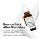 thumbnail image 5 of Sérum The Ordinary Aloe 2% + NAG 2% Solution 30 ml, 5 of 6