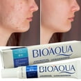 thumbnail image 4 of Anti Acne Crema Cicatrices Cacarizos Grasa Tratamiento Piel ANTI- ACNÉ ANTI- ACNE, 4 of 10