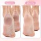 thumbnail image 2 of 13Pcs Replacement Roller Heads for Flawless Pedi, Compatible with Finishing Touches Flawless Pedi Electric Foot File,Home Pedicure Kit, 6 Black Coarse＆3 Gray Fine＆3 Pink Fine,a Cleaning Brush, 2 of 5