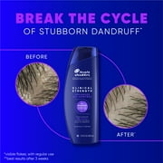 Head and Shoulders Clinical Strength Advanced Oil Control Dandruff Shampoo, 13.5 fl oz