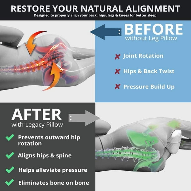 Sleeping with pillow between legs sciatica 2025