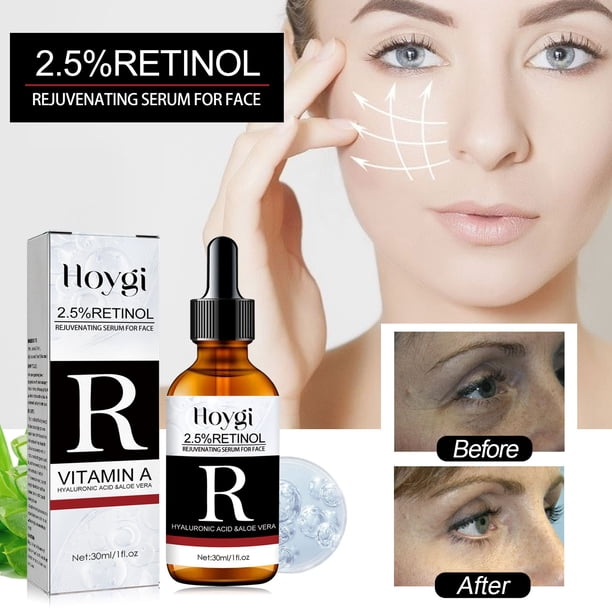Teissuly Retinol Serum Bio-Active Essence, Powerful Face Moisturizer, Day and Night Facial Serum, Reduces Fine Lines and Dryness, 30 ml Teissuly WER202401272274