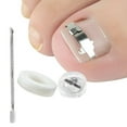 thumbnail image 1 of Herramienta de corrección de uñas encarnadas Colcomx tratamiento, 1 of 8