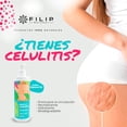 thumbnail image 2 of FILIP NATURAL, Crema Humectante De Menta Y Hamamelis, Auxiliar En Piernas Cansadas, Piernas Con Várices, Moretones, Promueve La Circulación, Ayuda A Disminuir Várices, 360ml., 2 of 3