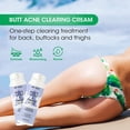 thumbnail image 3 of Tratamiento de limpieza del acné en los glúteos, tratamiento del acné en los glúteos, limpieza del acné, espinillas, granos, protuberancias de afeitar para las nalgas y el área de los muslos, 3 of 7
