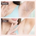 thumbnail image 5 of Electric Shaver compatible Women, Women's Shaver Trimmer compatible Body, Armpits, Legs and Bikini Zone, Compact Lady Shaver_Perfect Gift, 5 of 5