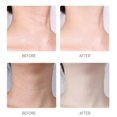 thumbnail image 3 of Quitar el dispositivo de belleza antiarrugas del escote para el cuidado del cuello, 3 of 5