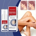 thumbnail image 2 of Vitiligo Treatment Spray, White Spots Remover Skin Renewal Herbal Spray, Improve Pigmentation Anti-Melanin Spray, 2 of 5