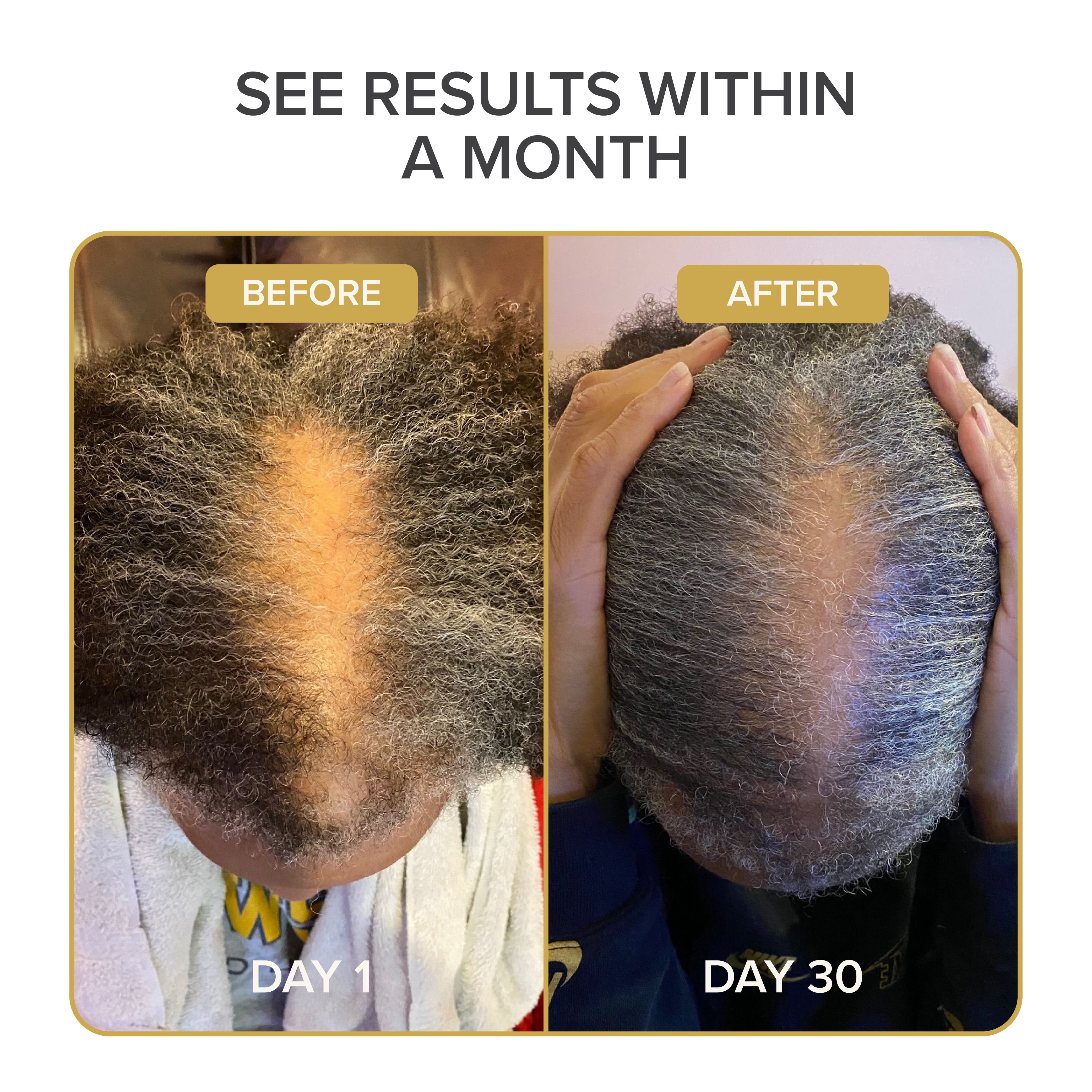 Shedavi Hair Growth Vitamin, 60 Count