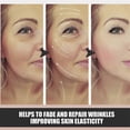 thumbnail image 4 of Women Anti Wrinkle Face Eye Forehead Invisible Anti-aging Pad Reusable Silicone Prevent Wrinkles Lines Patch Facial Care, 4 of 5