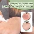 thumbnail image 3 of Anti-fungal Cream for Men and Women,Male and Female Anti/Fungal Cream,Anti/fungal Cream to Quickly Relieve Itching,Effectively Relieve Itching and Rem, 3 of 5