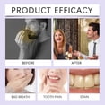 thumbnail image 4 of Probiotics Oral Spray Long Lasting-Freshness Mouth Spray with Probiotics Portable Mints Breath Freshener Alcohol-Free, 4 of 5