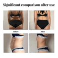 thumbnail image 3 of Sl Chang Abdominal Lifting Patches293, 3 of 5