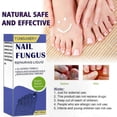 thumbnail image 3 of Effective Nail Fungus Treatment - 30ml Antifungal Solution for Stronger, Healthier Nails, 3 of 5