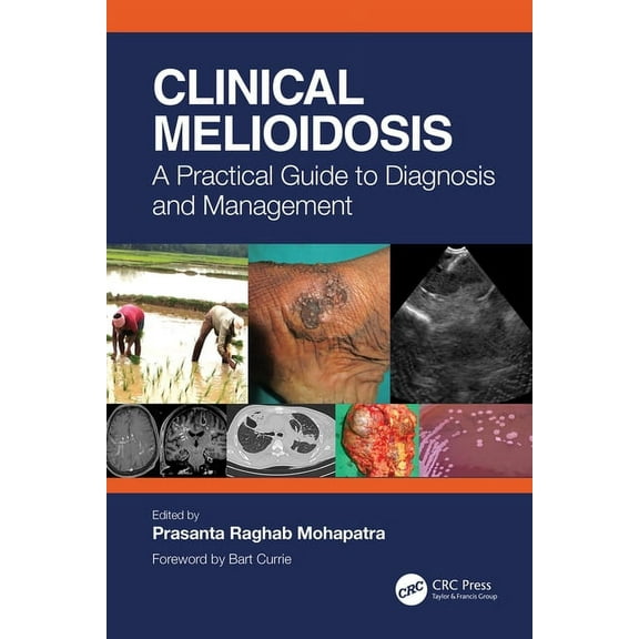 Clinical Melioidosis: A Practical Guide to Diagnosis and Management, (Paperback)