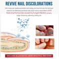 thumbnail image 2 of Fungal Fluid 10ml Alivia la esencia de uñas encarnadas para el cuidado de los pies, 2 of 6