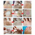 thumbnail image 4 of Almohadillas Removedoras De Verrugas En Los Pies Tmvgtek Cuidado Belleza, 4 of 6