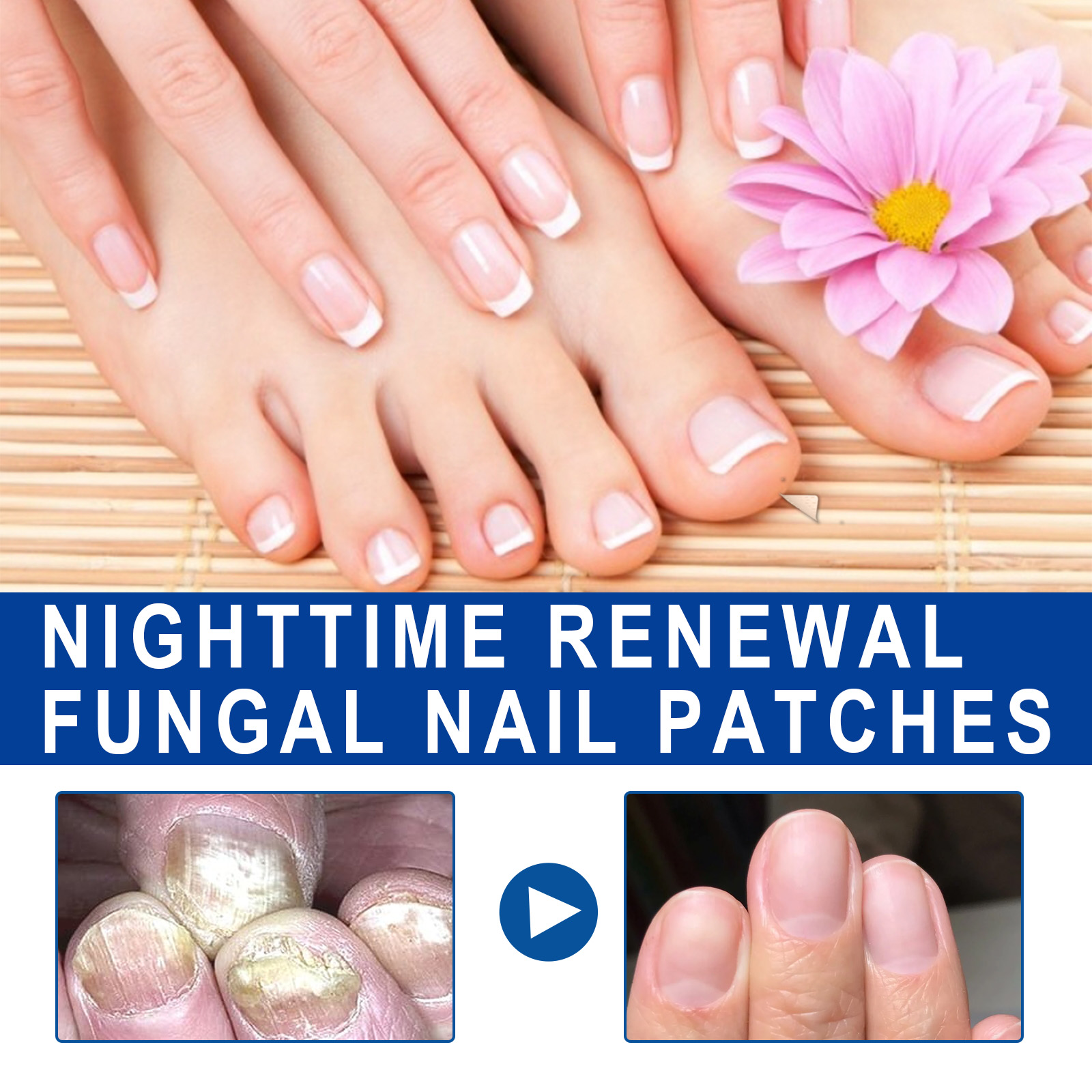 Alvantor Fungal Nail Patches, Overnight Repair for Damaged Thick Toenails, 8-Hour Treatment, 32PCS