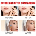 thumbnail image 3 of Pimple Patches for Face Hydrocolloid Acne Patches Versitile Cute Star Zit Covers Spot Stickers Mild and non-irritating Patches 5 Color 3 Sizes, 3 of 5