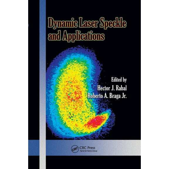 Optical Science and Engineering Dynamic Laser Speckle and Applications, (Paperback)