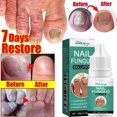 thumbnail image 4 of Tratamiento de uñas AFeng 10ml, 4 of 5