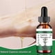 thumbnail image 5 of Natural Hair Growth Inhibitor Oil, 60ml Bottle, Cyperus Rotundus Extract for Hair Reduction Solution, 5 of 5