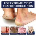 thumbnail image 3 of 1pc Jaysuing Anti-crack Repair Hand Cream Exfoliate To Improve Cracked And Rough Skin Moisturizing Moisturizing Hand Cream, 3 of 4