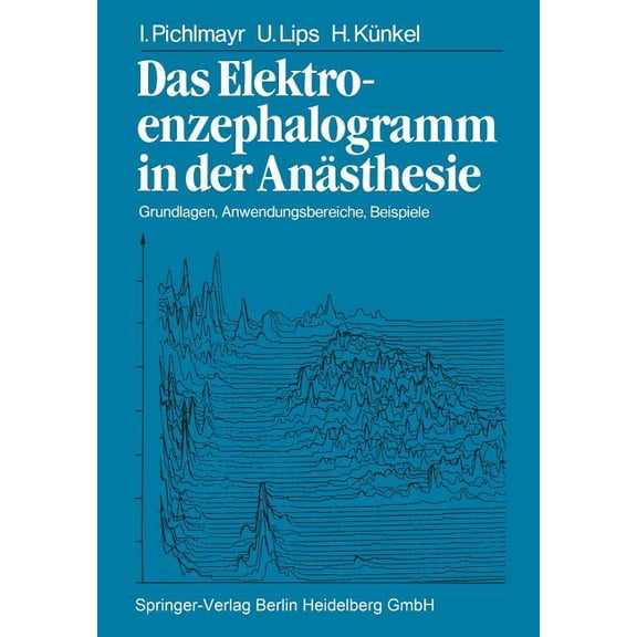 Das Elektroenzephalogramm in Der AnÃ¤sthesie: Grundlagen, Anwendungsbereiche, Beispiele, (Paperback)