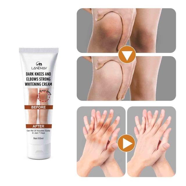 Xihbxyly Oferta del día Liquidación Suero blanqueador de articulaciones para blanquear la piel de las axilas y los codos, para eliminar la melanina de las rodillas, 50 ml