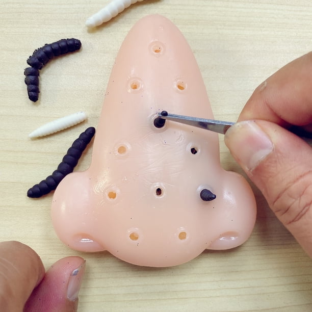 Juguete para Apretar Espinillas, Alivia El Estrés Y La Ansiedad Atención Exprimir El Acné Juguetes Sensoriales para Adultos Niños con Pinza Juguete De Descompresión para El Autismo XianweiShao 8390615120364