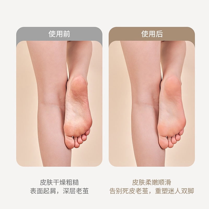 Electric foot grinder exfoliating full body washing automatic pedicure tool rechargeable pedicure tool